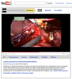 Video: Laparoskopische Pankreaskopfresektion